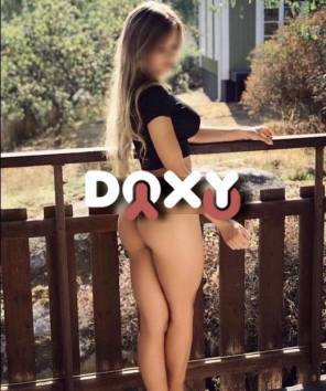 Фотография номер 5 - Лиса, 19 лет